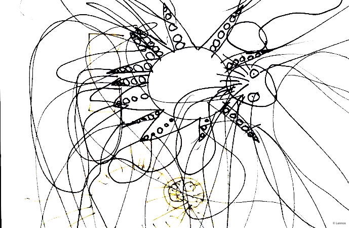 ÉDITORIAL : Le réel de l’autiste